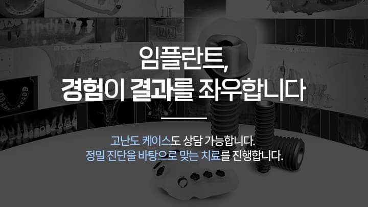 배너 3