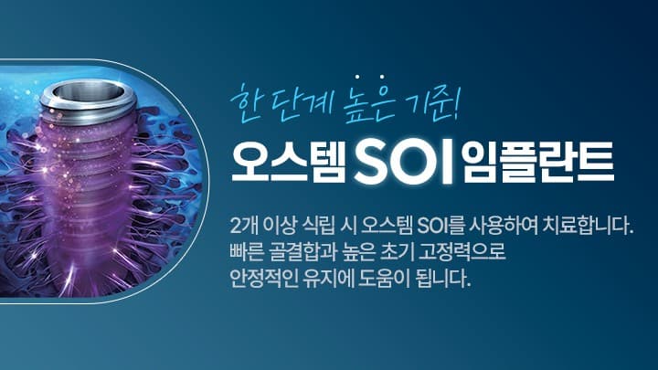배너 4